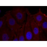 Immunofluorescence - a-Synuclein (Phospho-Tyr133) Antibody from Signalway Antibody (11285) - Antibodies.com