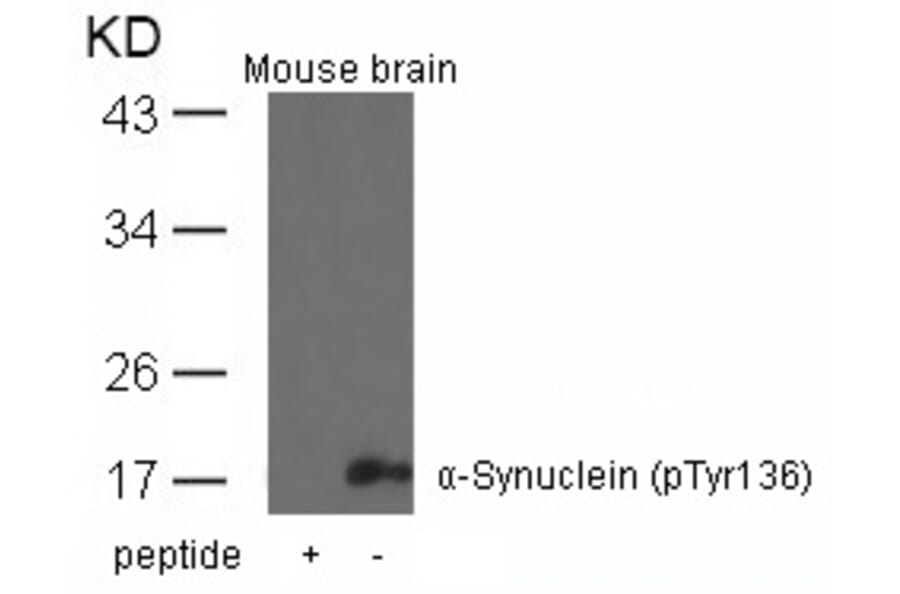 Western blot - a-Synuclein (Phospho-Tyr136) Antibody from Signalway Antibody (11286) - Antibodies.com