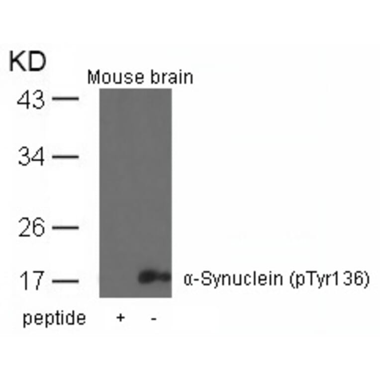 Western blot - a-Synuclein (Phospho-Tyr136) Antibody from Signalway Antibody (11286) - Antibodies.com