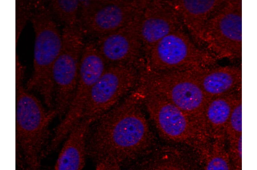 Immunofluorescence - a-Synuclein (Phospho-Tyr136) Antibody from Signalway Antibody (11286) - Antibodies.com
