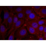 Immunofluorescence - a-Synuclein (Phospho-Tyr136) Antibody from Signalway Antibody (11286) - Antibodies.com