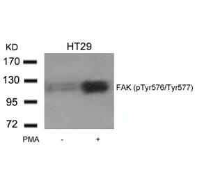 Western blot - FAK (phospho-Tyr576/Tyr577) Antibody from Signalway Antibody (11545) - Antibodies.com