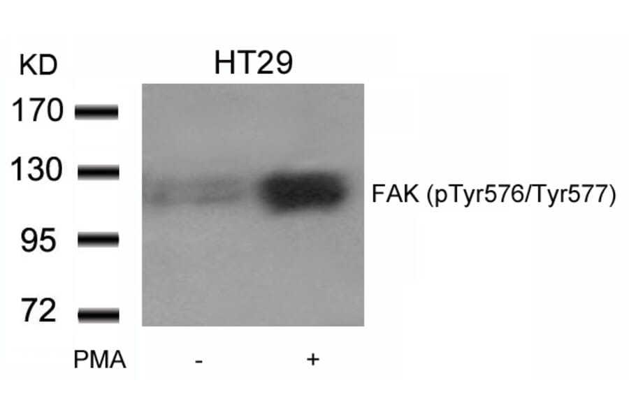Western blot - FAK (phospho-Tyr576/Tyr577) Antibody from Signalway Antibody (11545) - Antibodies.com