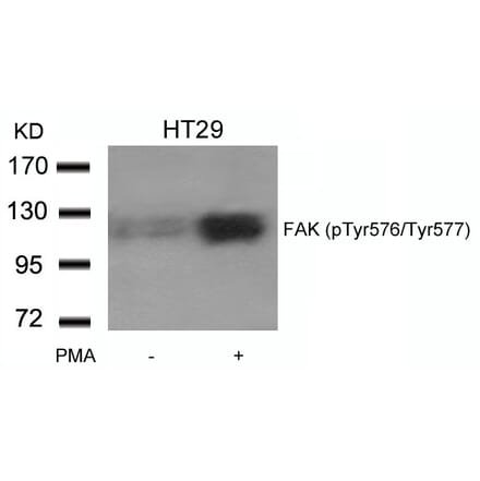 Western blot - FAK (phospho-Tyr576/Tyr577) Antibody from Signalway Antibody (11545) - Antibodies.com