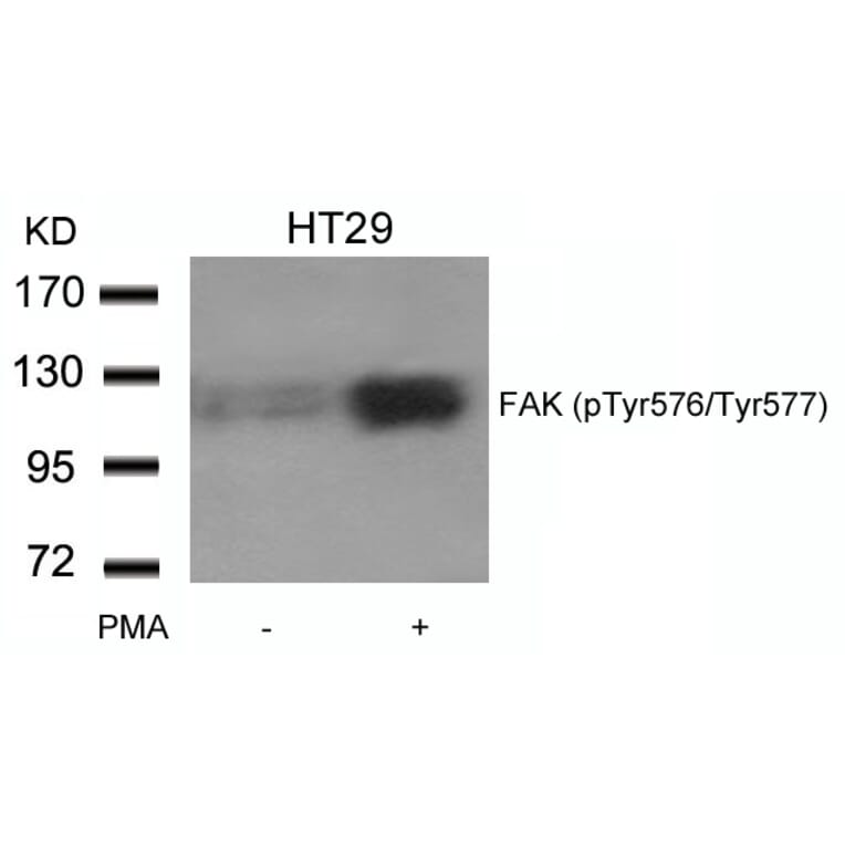 Western blot - FAK (phospho-Tyr576/Tyr577) Antibody from Signalway Antibody (11545) - Antibodies.com