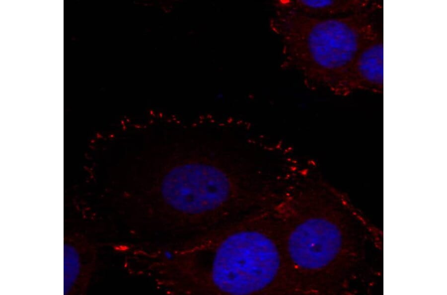 Immunofluorescence - FAK (phospho-Tyr576/Tyr577) Antibody from Signalway Antibody (11545) - Antibodies.com