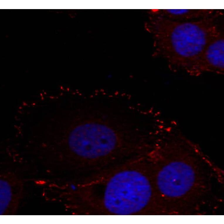 Immunofluorescence - FAK (phospho-Tyr576/Tyr577) Antibody from Signalway Antibody (11545) - Antibodies.com