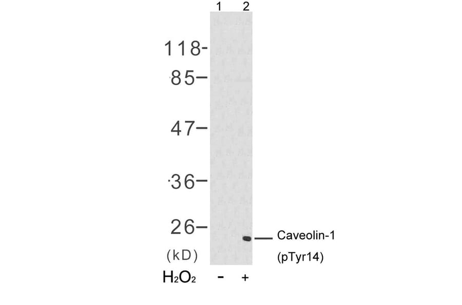 Western blot - Caveolin-1 (Phospho-Tyr14) Antibody from Signalway Antibody (11090) - Antibodies.com