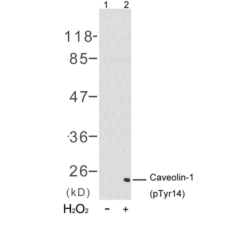 Western blot - Caveolin-1 (Phospho-Tyr14) Antibody from Signalway Antibody (11090) - Antibodies.com