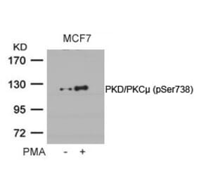 Western blot - PKD/PKCm (Phospho-Ser738) Antibody from Signalway Antibody (11078) - Antibodies.com