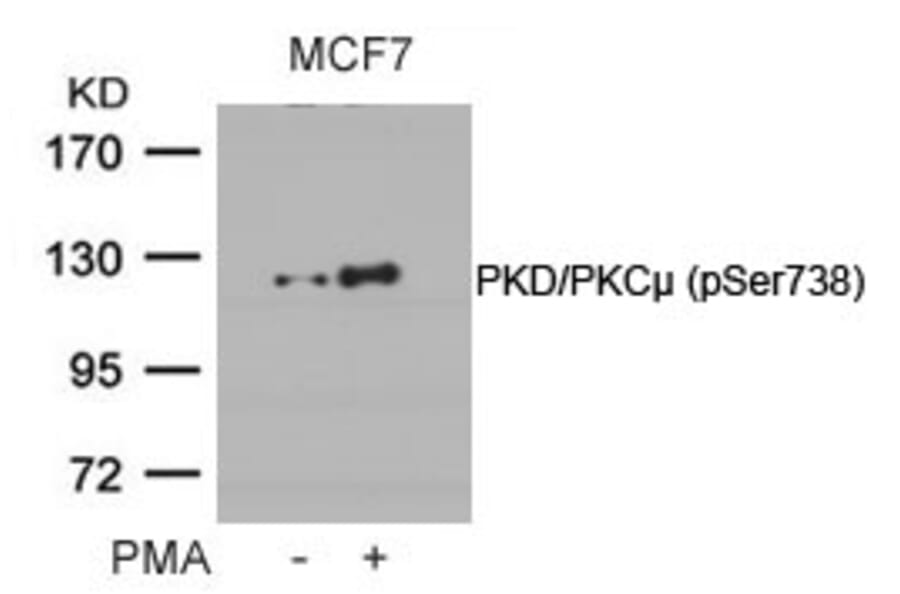 Western blot - PKD/PKCm (Phospho-Ser738) Antibody from Signalway Antibody (11078) - Antibodies.com