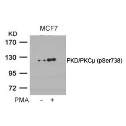 Western blot - PKD/PKCm (Phospho-Ser738) Antibody from Signalway Antibody (11078) - Antibodies.com