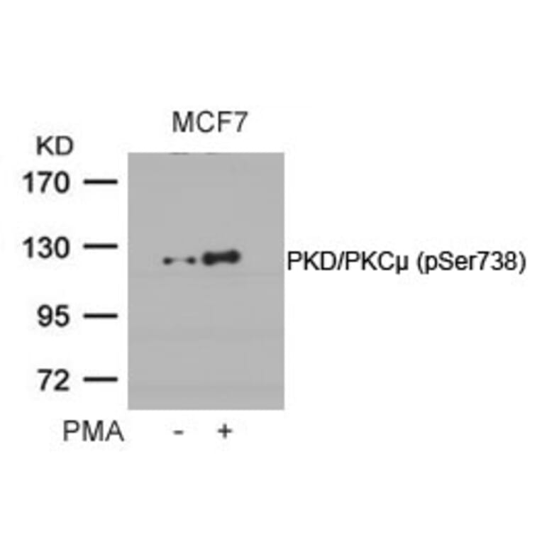 Western blot - PKD/PKCm (Phospho-Ser738) Antibody from Signalway Antibody (11078) - Antibodies.com