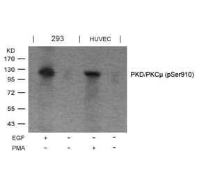 Western blot - PKD/PKCm (Phospho-Ser910) Antibody from Signalway Antibody (11096) - Antibodies.com