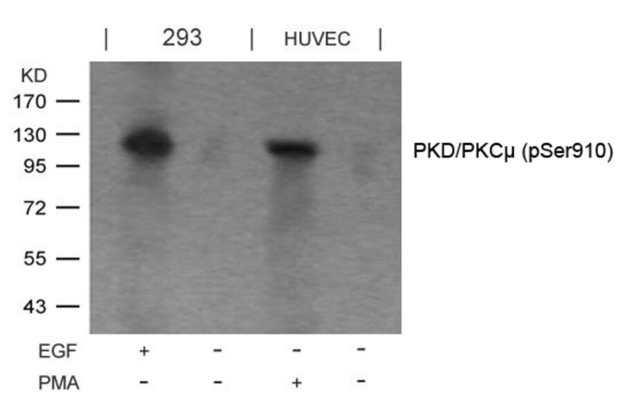 Western blot - PKD/PKCm (Phospho-Ser910) Antibody from Signalway Antibody (11096) - Antibodies.com