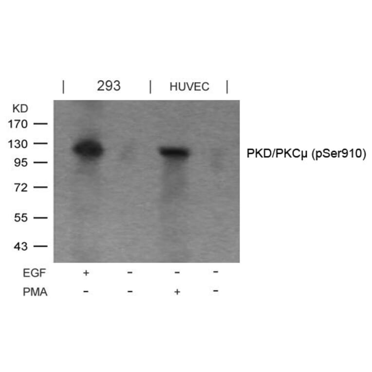 Western blot - PKD/PKCm (Phospho-Ser910) Antibody from Signalway Antibody (11096) - Antibodies.com
