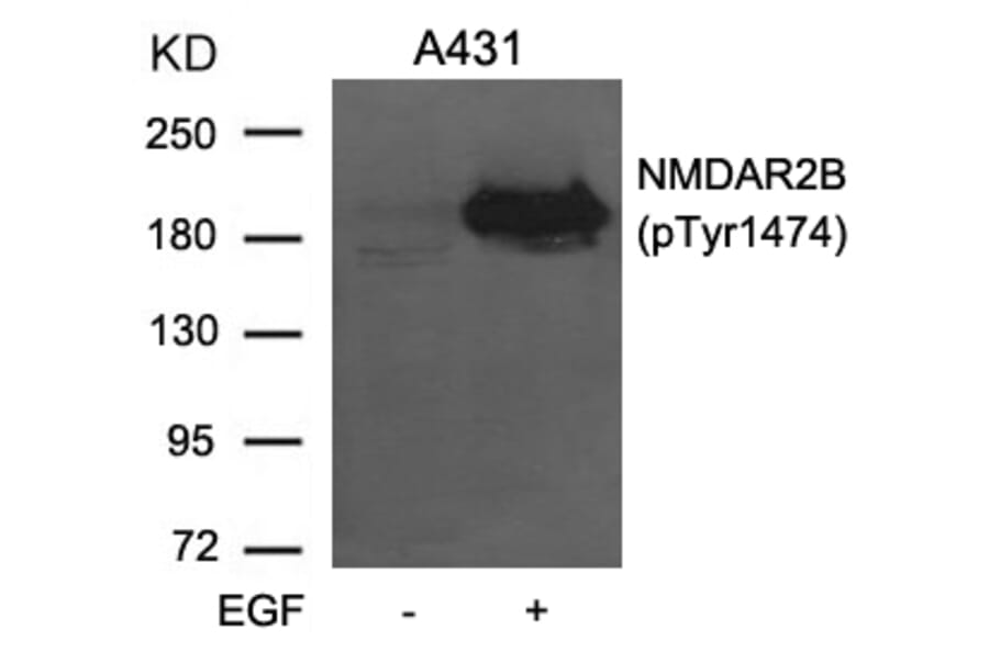Western blot - NMDAR2B (phospho-Tyr1474) Antibody from Signalway Antibody (11168) - Antibodies.com