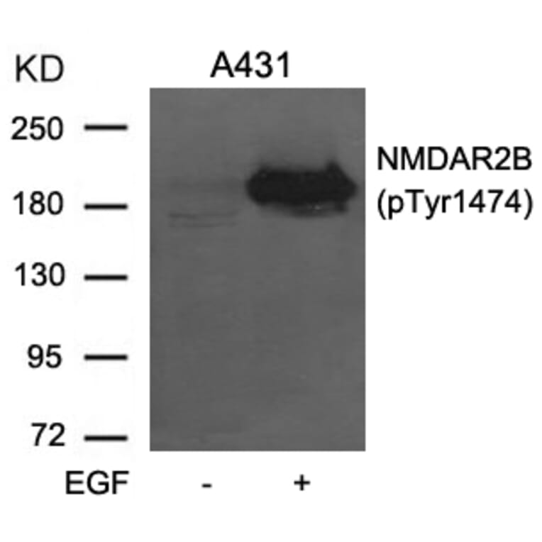 Western blot - NMDAR2B (phospho-Tyr1474) Antibody from Signalway Antibody (11168) - Antibodies.com