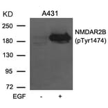 Western blot - NMDAR2B (phospho-Tyr1474) Antibody from Signalway Antibody (11168) - Antibodies.com