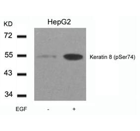 Western blot - Keratin 8 (Phospho-Ser74) Antibody from Signalway Antibody (11307) - Antibodies.com