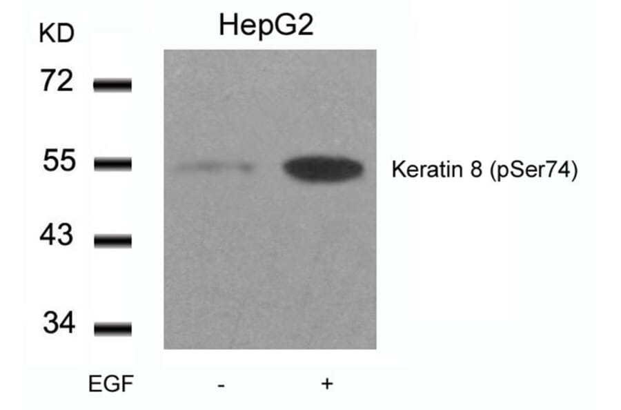 Western blot - Keratin 8 (Phospho-Ser74) Antibody from Signalway Antibody (11307) - Antibodies.com