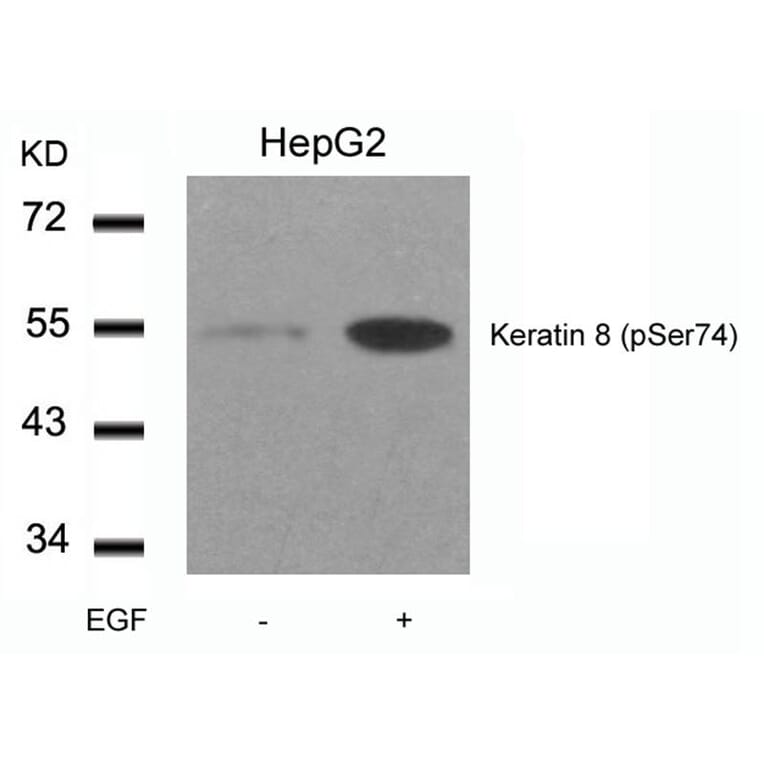 Western blot - Keratin 8 (Phospho-Ser74) Antibody from Signalway Antibody (11307) - Antibodies.com