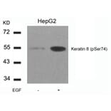Western blot - Keratin 8 (Phospho-Ser74) Antibody from Signalway Antibody (11307) - Antibodies.com