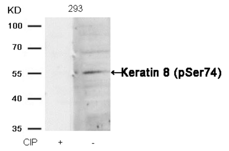 Western blot - Keratin 8 (Phospho-Ser74) Antibody from Signalway Antibody (11307) - Antibodies.com