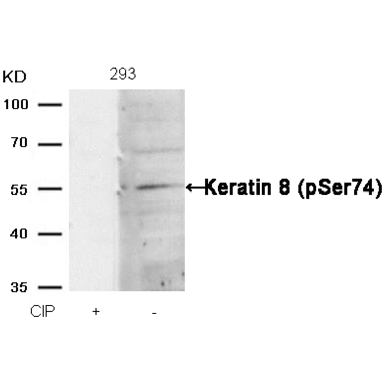 Western blot - Keratin 8 (Phospho-Ser74) Antibody from Signalway Antibody (11307) - Antibodies.com