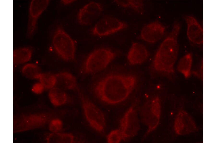 Immunofluorescence - NFκB-p65 (Phospho-Ser468) Antibody from Signalway Antibody (11013) - Antibodies.com