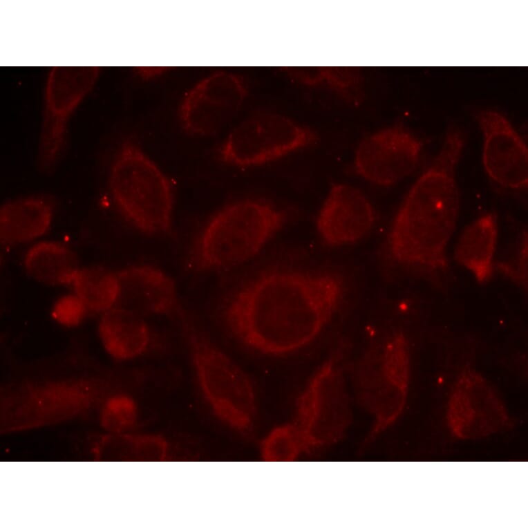 Immunofluorescence - NFκB-p65 (Phospho-Ser468) Antibody from Signalway Antibody (11013) - Antibodies.com