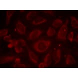 Immunofluorescence - NFκB-p65 (Phospho-Ser468) Antibody from Signalway Antibody (11013) - Antibodies.com