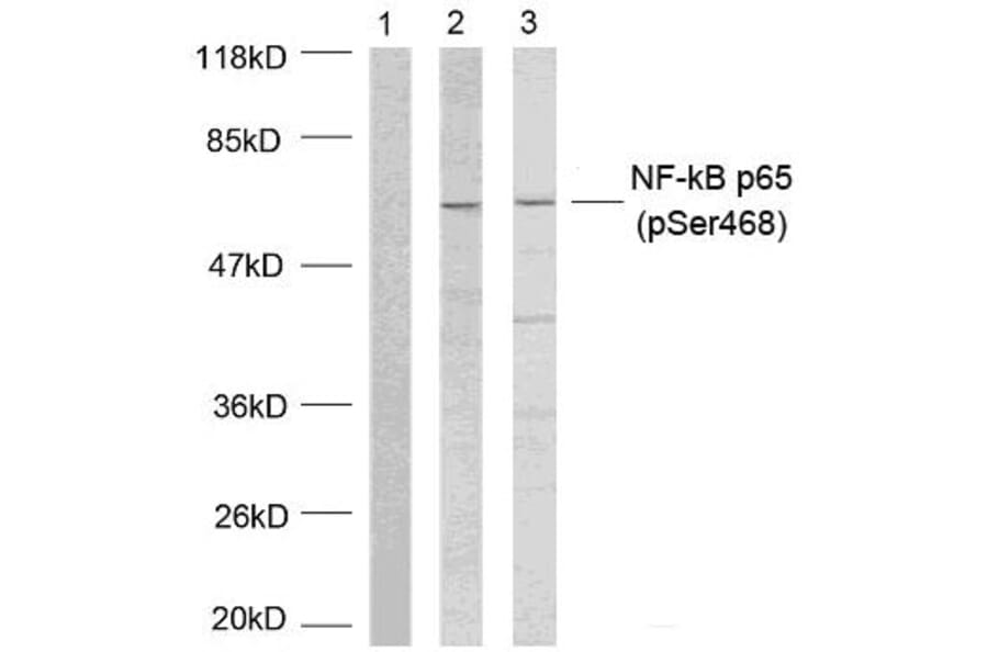 Western blot - NFκB-p65 (Phospho-Ser468) Antibody from Signalway Antibody (11013) - Antibodies.com