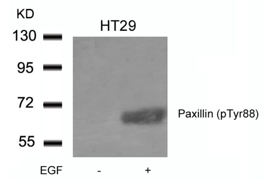 Western blot - Paxillin (phospho-Tyr88) Antibody from Signalway Antibody (11538) - Antibodies.com
