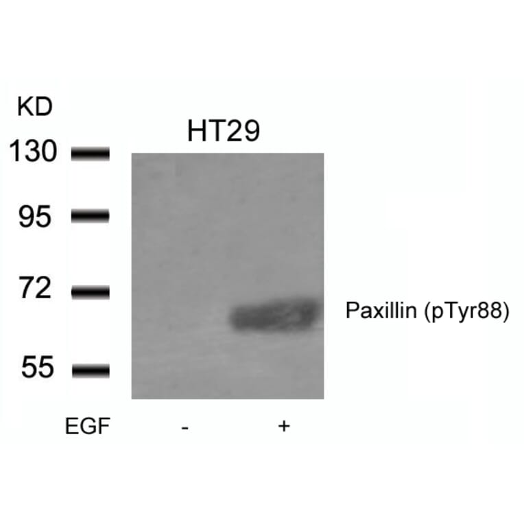 Western blot - Paxillin (phospho-Tyr88) Antibody from Signalway Antibody (11538) - Antibodies.com