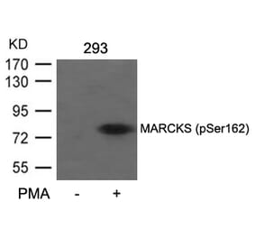 Western blot - MARCKS (Phospho-Ser162) Antibody from Signalway Antibody (11265) - Antibodies.com