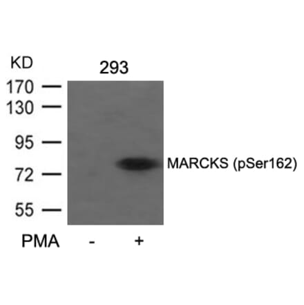 Western blot - MARCKS (Phospho-Ser162) Antibody from Signalway Antibody (11265) - Antibodies.com