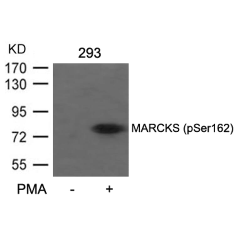 Western blot - MARCKS (Phospho-Ser162) Antibody from Signalway Antibody (11265) - Antibodies.com