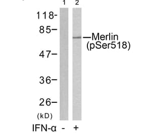 Western blot - Merlin (Phospho-Ser518) Antibody from Signalway Antibody (11266) - Antibodies.com