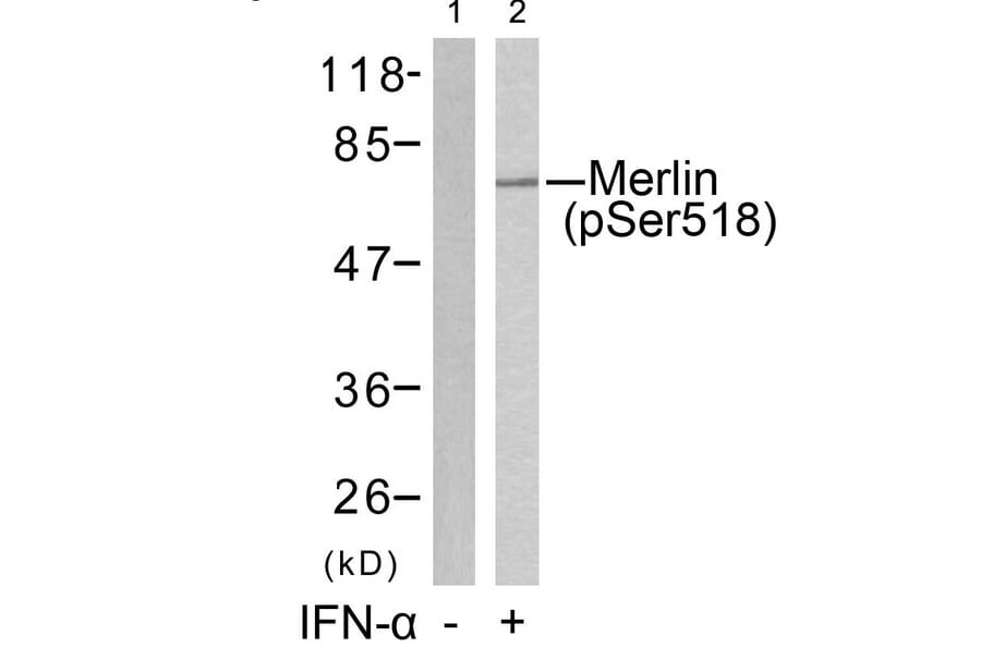 Western blot - Merlin (Phospho-Ser518) Antibody from Signalway Antibody (11266) - Antibodies.com