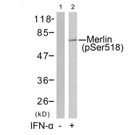 Western blot - Merlin (Phospho-Ser518) Antibody from Signalway Antibody (11266) - Antibodies.com