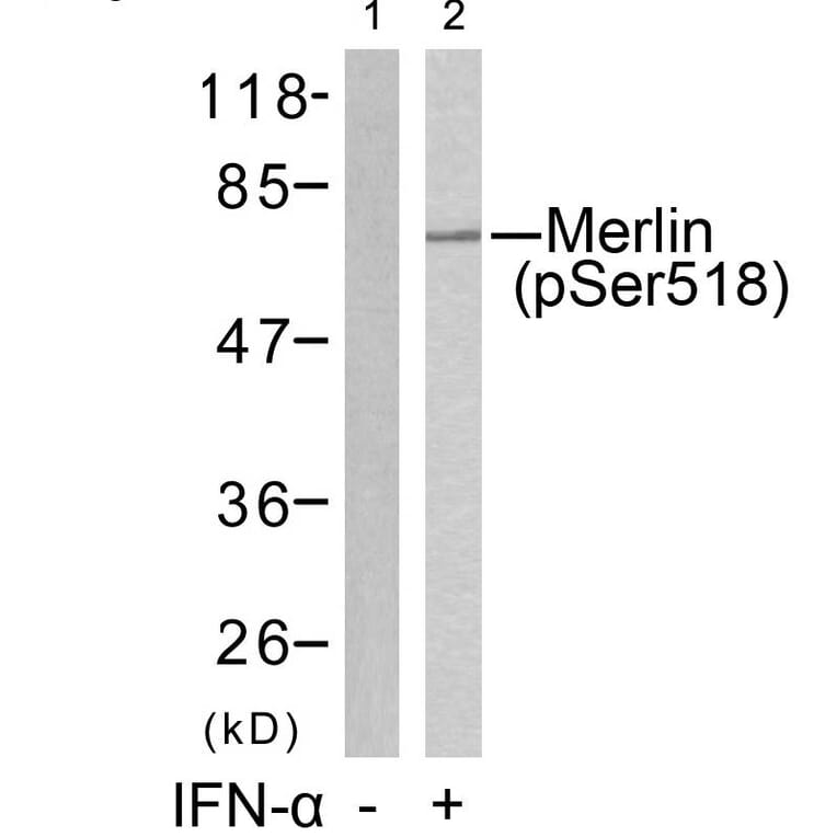 Western blot - Merlin (Phospho-Ser518) Antibody from Signalway Antibody (11266) - Antibodies.com