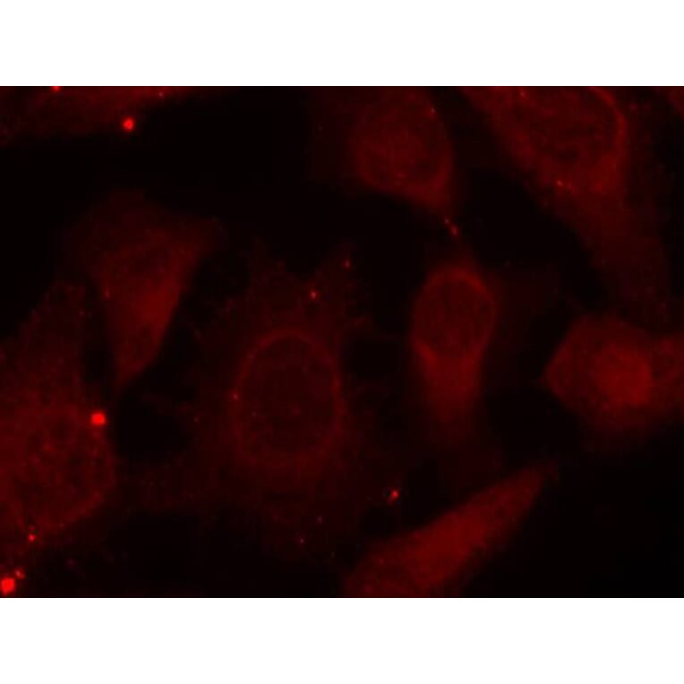 Immunofluorescence - Merlin (Phospho-Ser518) Antibody from Signalway Antibody (11266) - Antibodies.com
