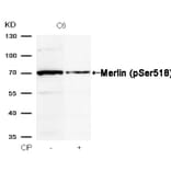 Western blot - Merlin (Phospho-Ser518) Antibody from Signalway Antibody (11266) - Antibodies.com