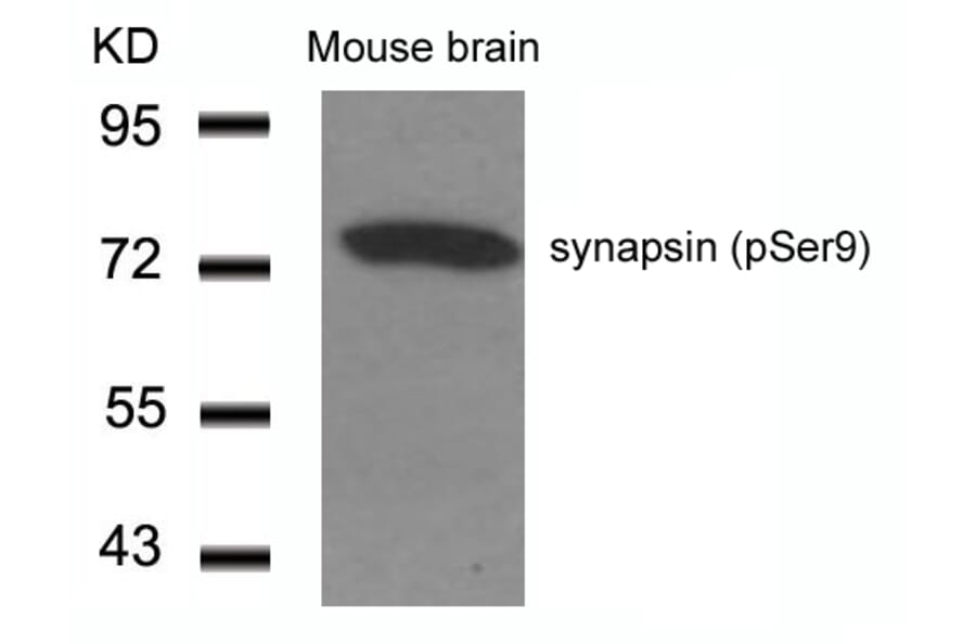 Western blot - synapsin (Phospho-Ser9) Antibody from Signalway Antibody (11267) - Antibodies.com