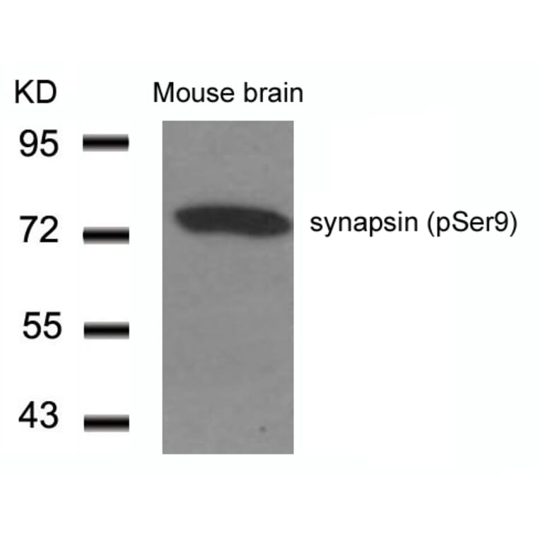Western blot - synapsin (Phospho-Ser9) Antibody from Signalway Antibody (11267) - Antibodies.com