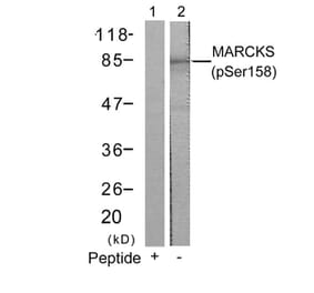 Western blot - MARCKS (Phospho-Ser158) Antibody from Signalway Antibody (11293) - Antibodies.com
