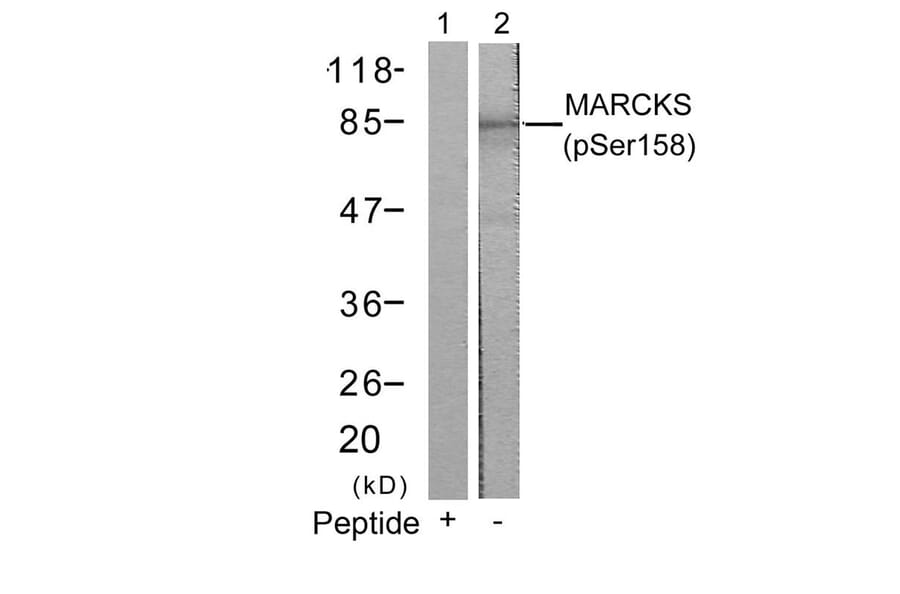 Western blot - MARCKS (Phospho-Ser158) Antibody from Signalway Antibody (11293) - Antibodies.com