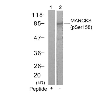 Western blot - MARCKS (Phospho-Ser158) Antibody from Signalway Antibody (11293) - Antibodies.com