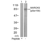 Western blot - MARCKS (Phospho-Ser158) Antibody from Signalway Antibody (11293) - Antibodies.com